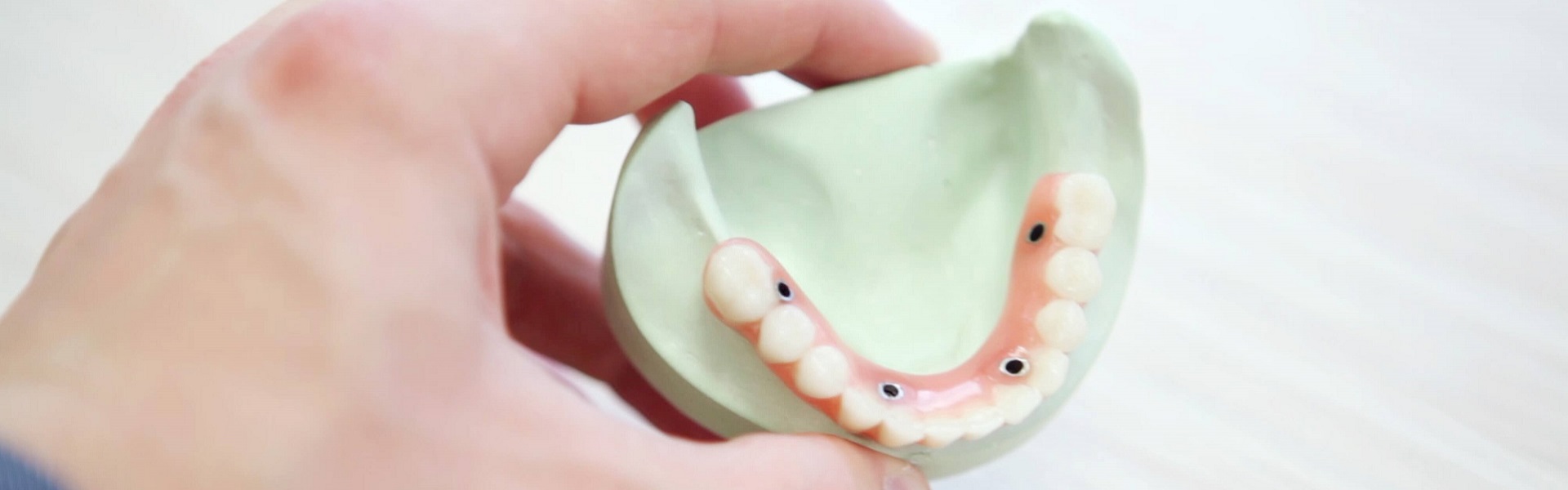 Zubni Implanti Beograd | Zubna tehnika
